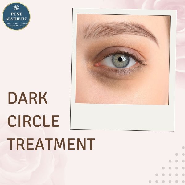dark circles treatment in pune