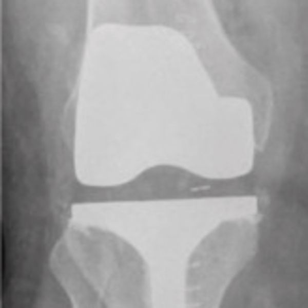 personalized physiotherapy car