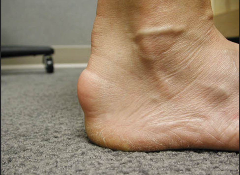 calf muscle