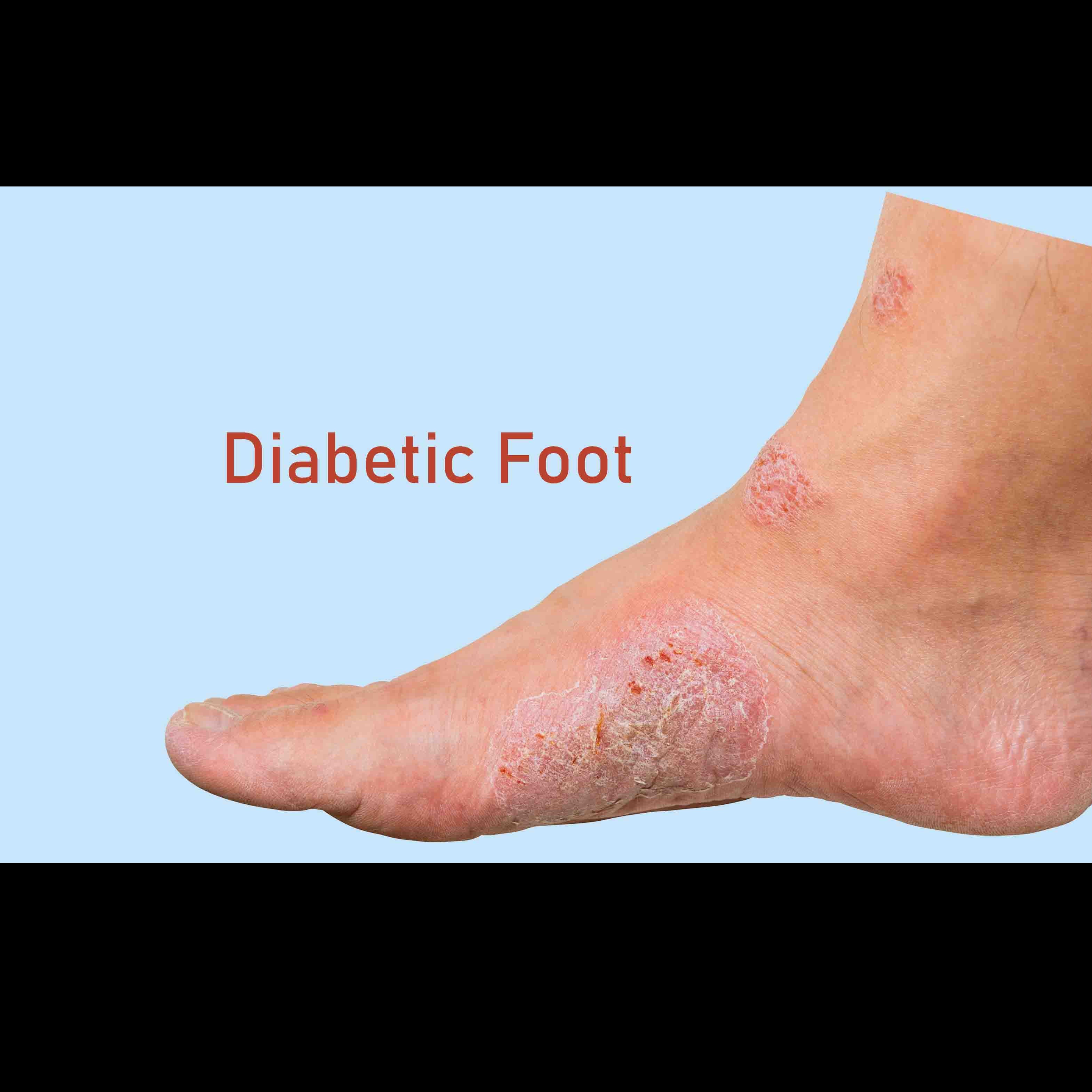 assistive devices