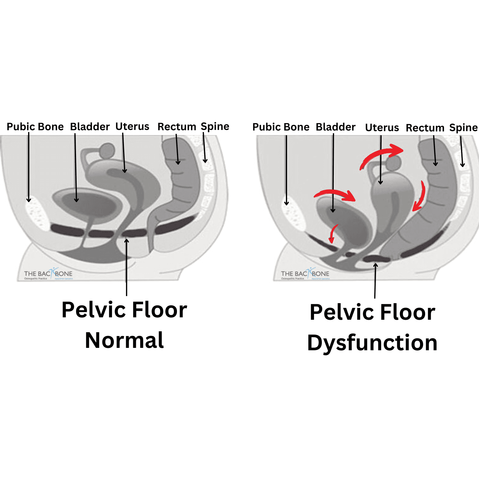 physiotherapy for pain and dys