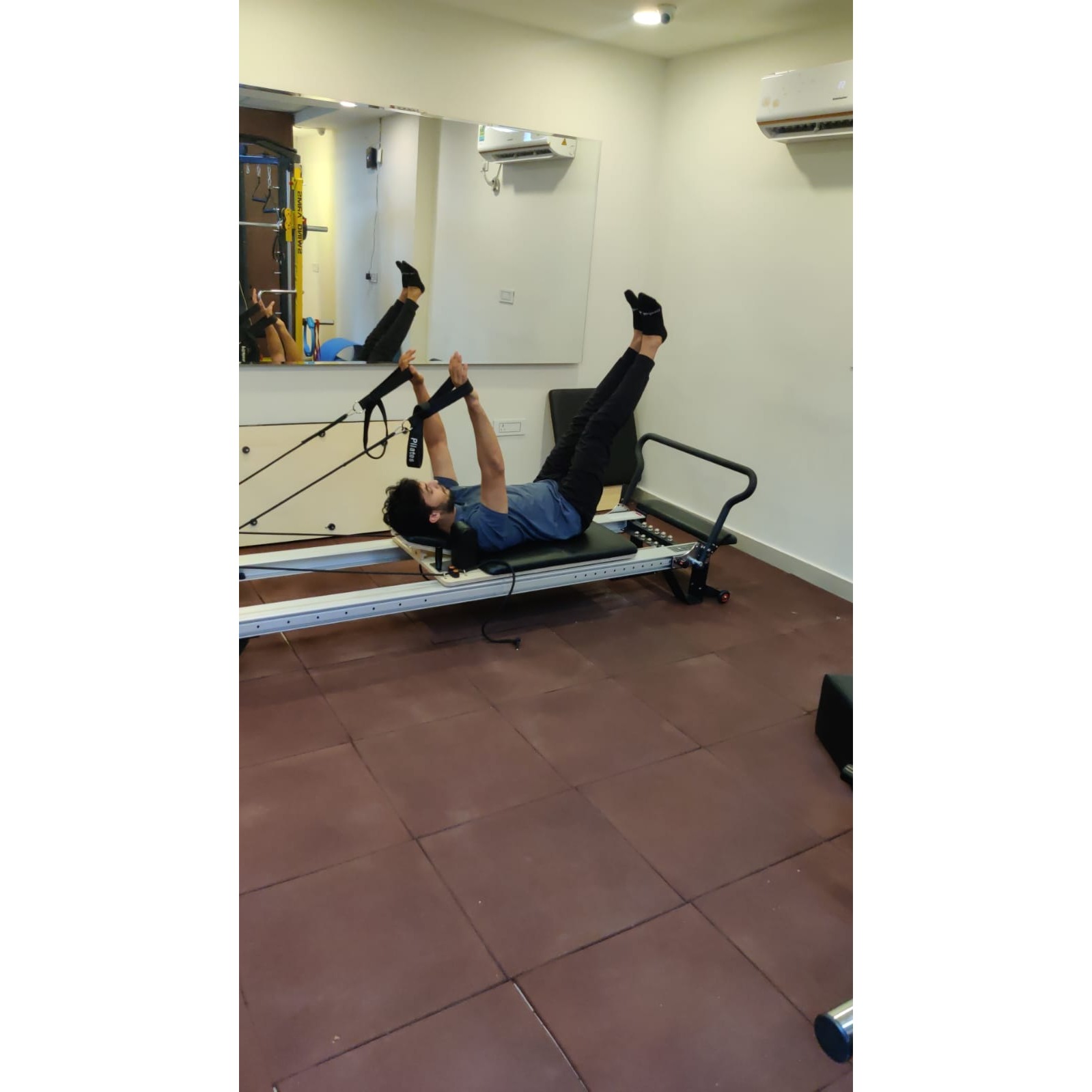 upper limbs