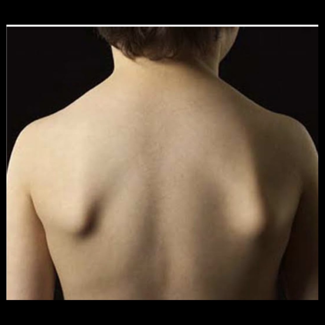 shoulder stability encourages