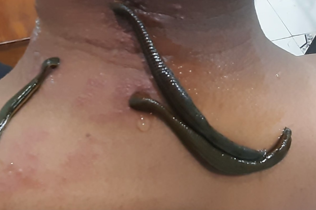 update image