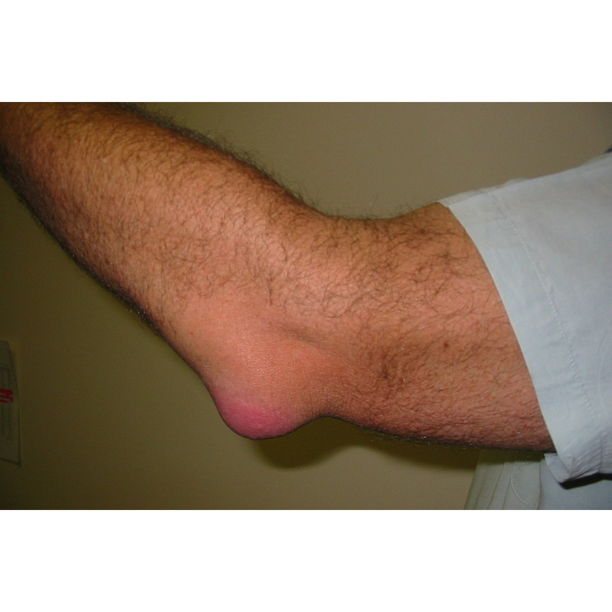 optimal recovery