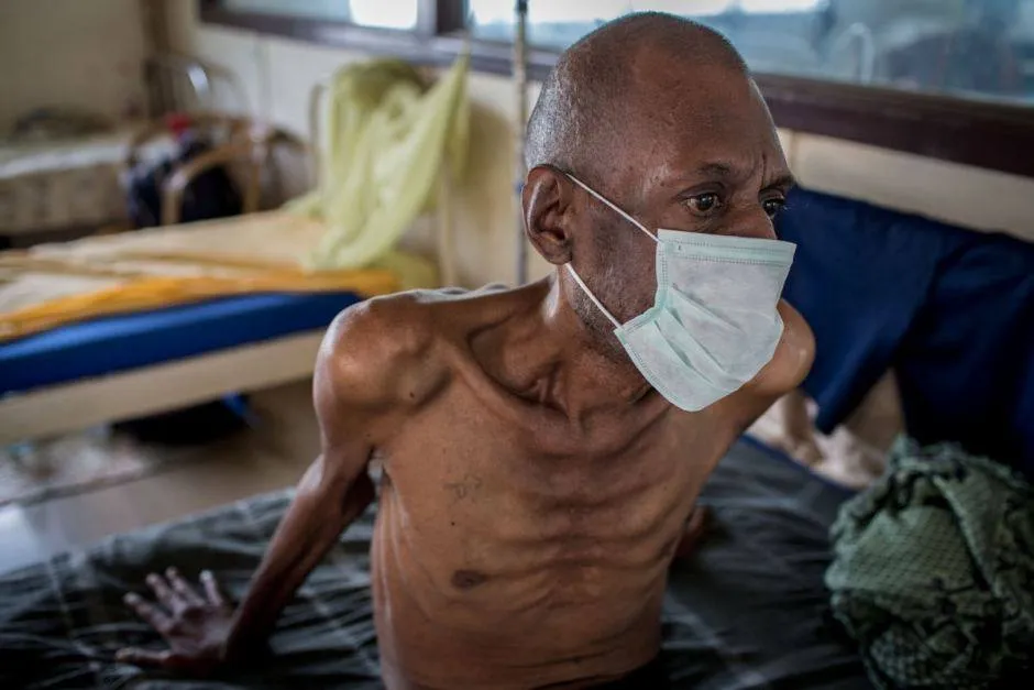 What is multidrug-resistant tuberculosis (MDR-TB) ...
