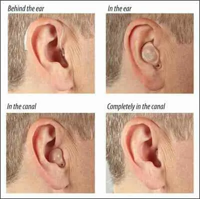 Our smallest hearing aids sit hidden in your ear a...
