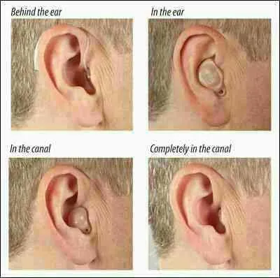 Our smallest hearing aids sit hidden in your ear a...