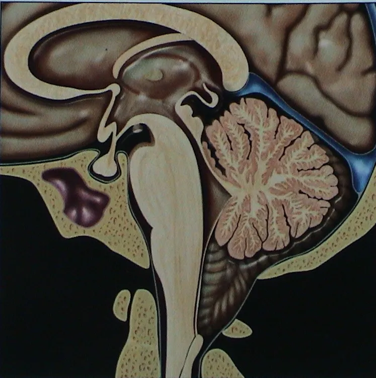 Surgery of the brain and spinal cord is done by sp...