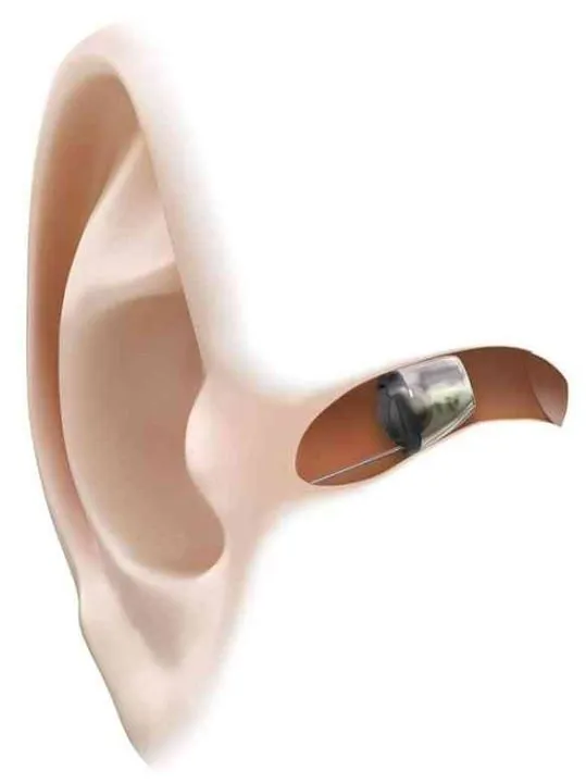 We take you nearer to the natural hearing level wi...