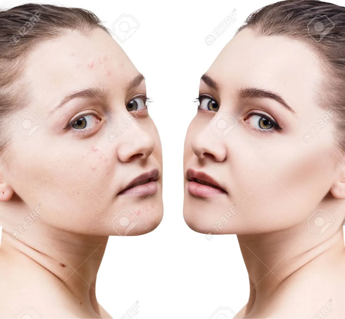 Skin And Hair Treatment Doctor in Nagpur
Dr. Rich...