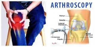 Hip Arthroscopy surgeon
Arthroscopy of the hip j...