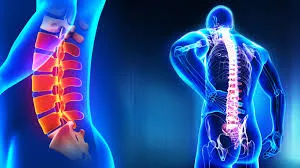 SPINAL TUMOURS SPINE SURGERY BY Dr. RAJENDRA LATKA...