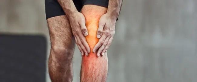 Arthritis disease
Arthritis is an inflammatory j...