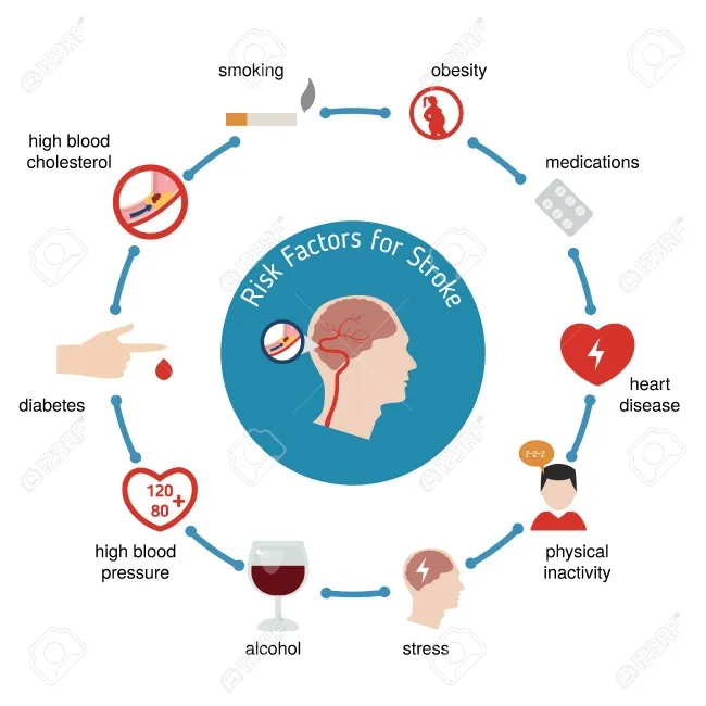 Risk factors for stroke or Brain attack.
Cerebrov...