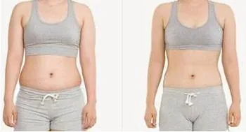 Slimming Treatment
Slimming Treatment
Given the fa...