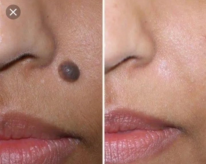 Nano homeopathy
Dr. Ma...