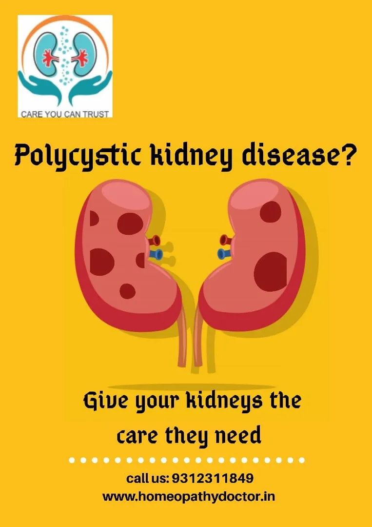 Polycystic kidney disease (PKD) is a genetic disea...