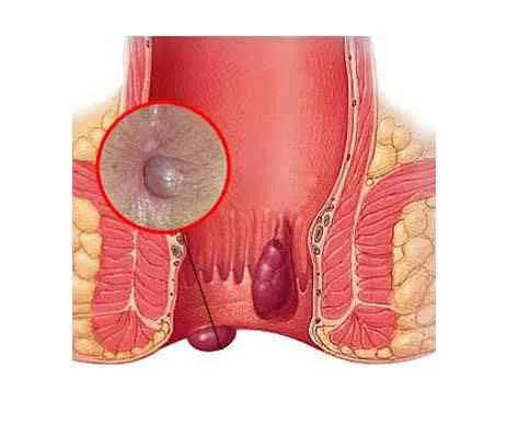 Dr.Phapale Hospital, Otur
Centre for Piles & Gener...