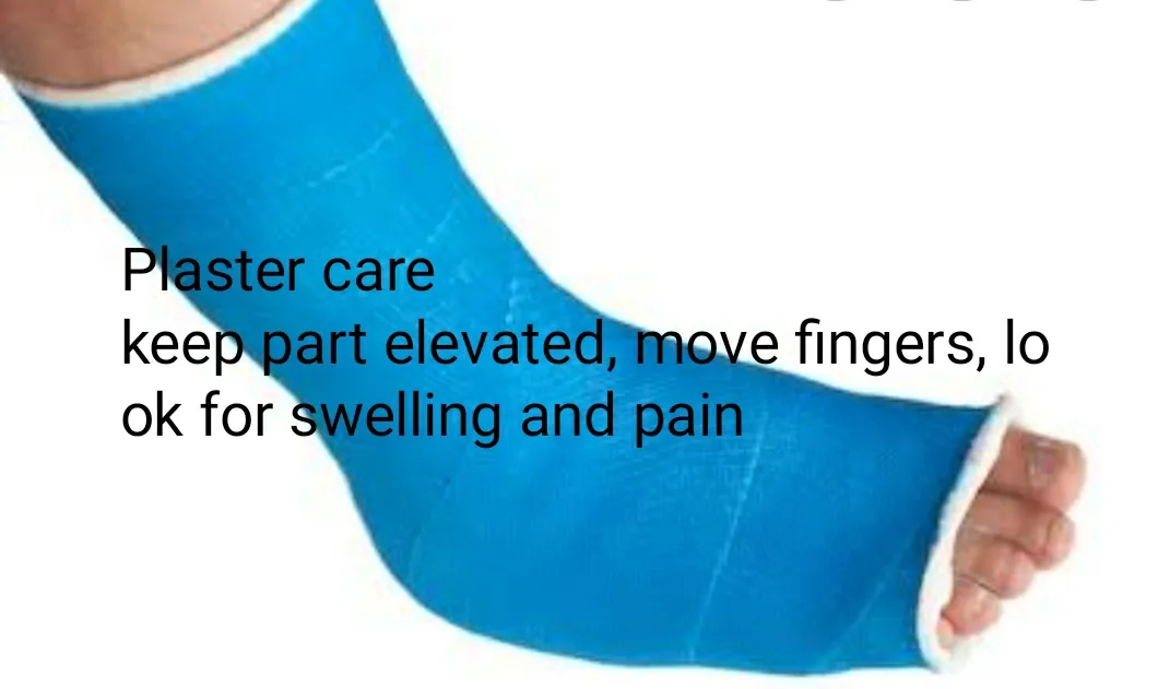Plaster care will reduce plaster related problems....