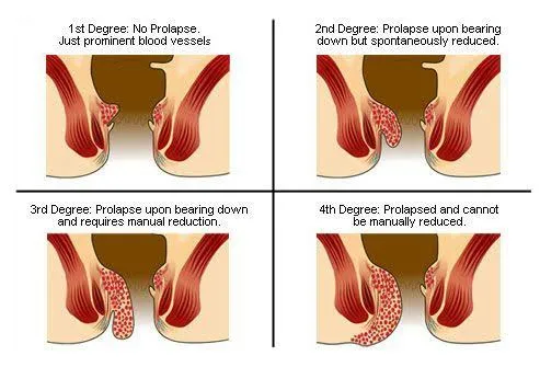 Dr.Phapale Hospital
Centre for Piles & General Sur...