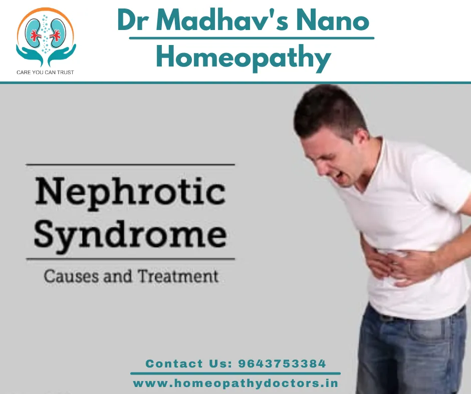 Nephrotic Syndrome Treatment by Dr Madhav Shyam, N...