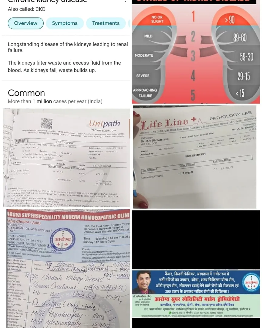 👆CKD KIDNEY FAILURE CREATININE 11.13 TO 1.7 mg/dl ...