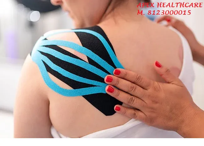 What is kinesiology tape used for?
Treating injuri...