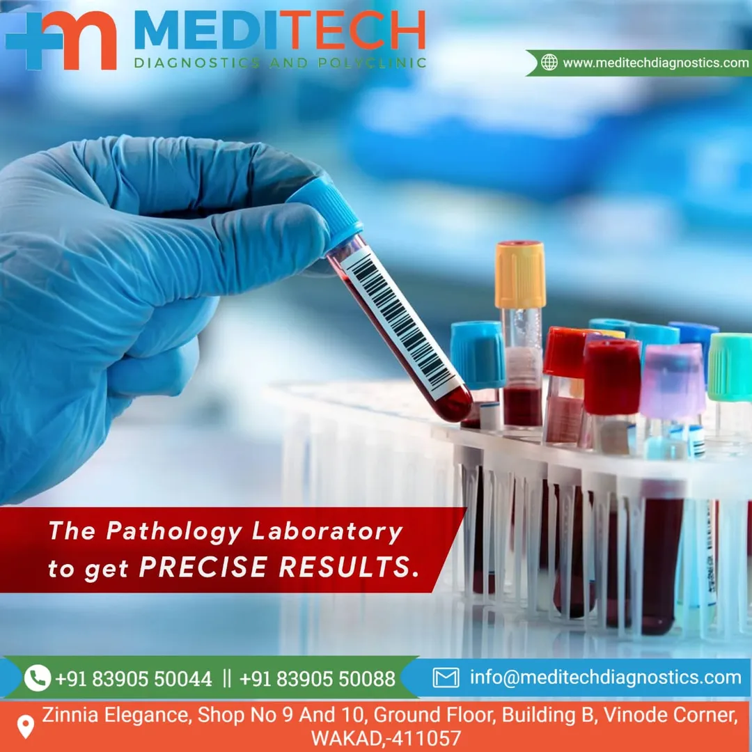 Are you Finding Laboratory in Wakad? Path Lab in W...