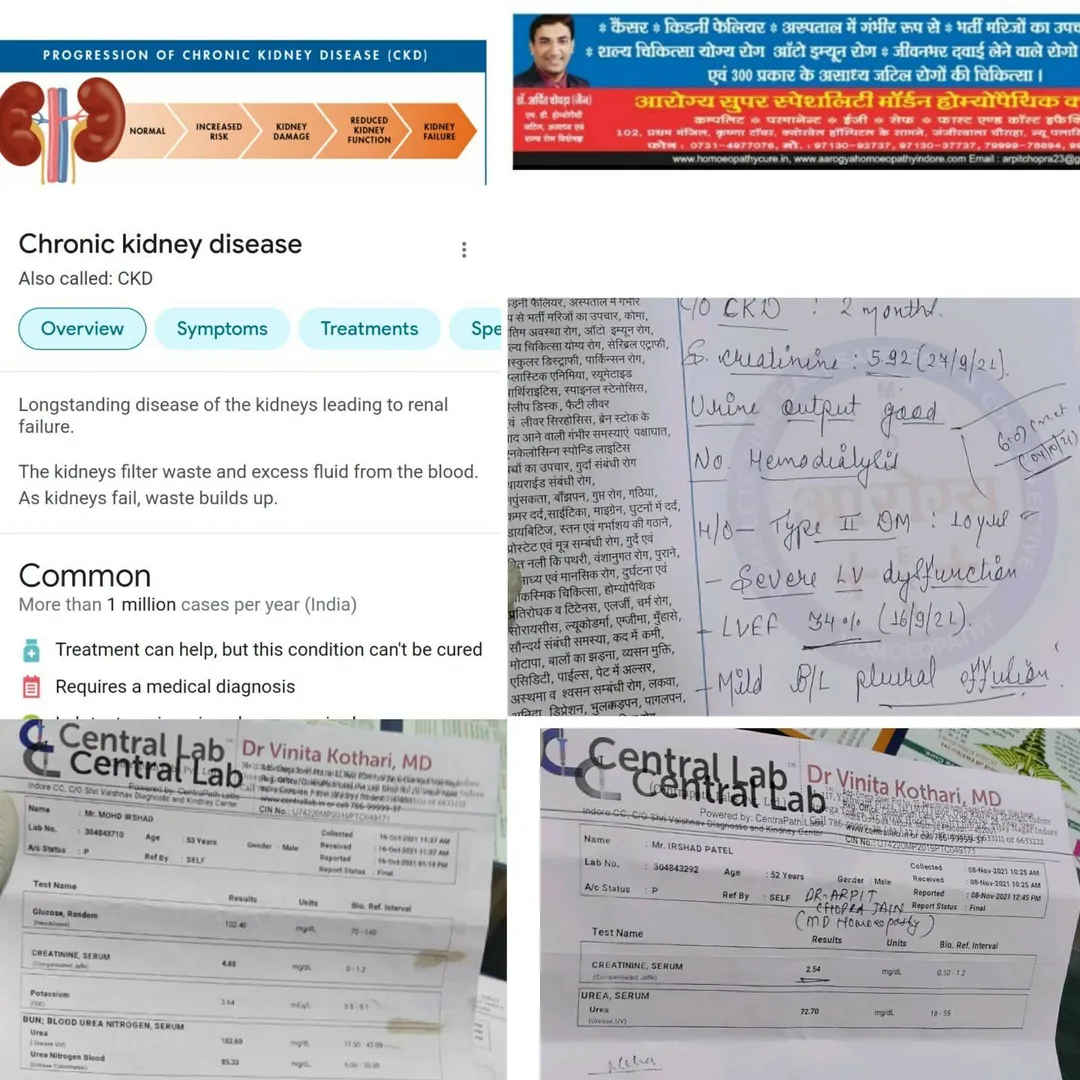 👆CHRONIC KIDNEY DISEASES CKD CREATININE 4.88 mg/d...