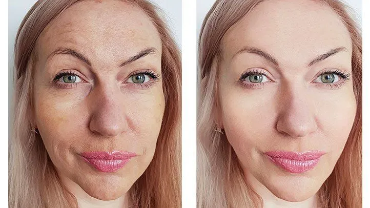 Best Skin Consultant in Ramesh Nagar -
To mainta...
