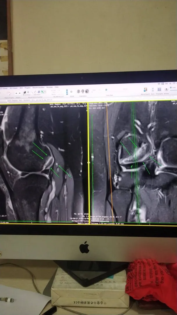CARTILAGE IS SMOOTH COVERING AT EACH ENDS OF BONE ...