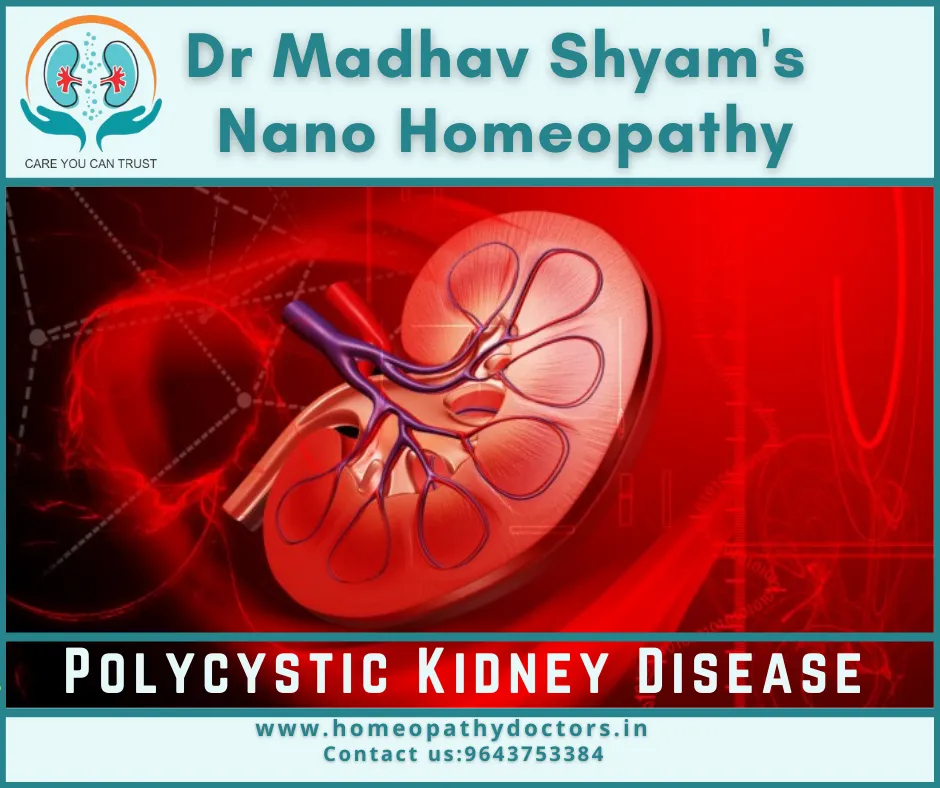 Polycystic kidney disease (PKD) is a genetic disea...