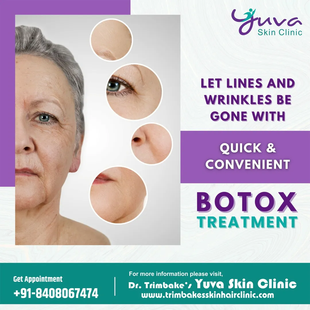 BOTOX TREATMENT
Botox is a non-surgical cosmetic t...