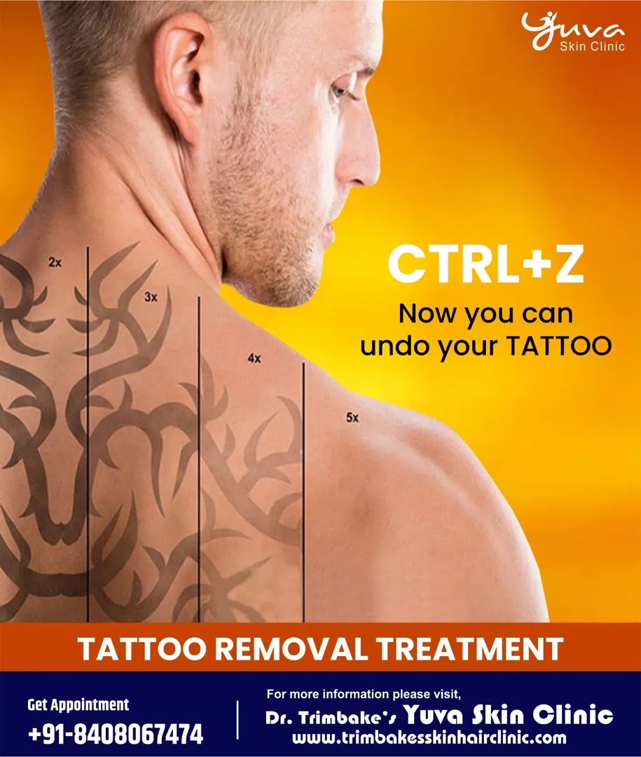 Tattoo Removal Treatment
Getting bored of your per...