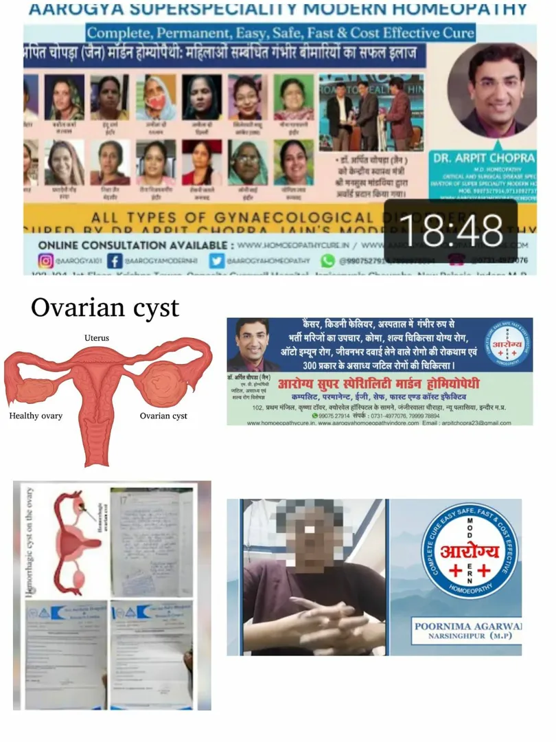 PCOD/PCOS, Ovarion Cyst cured without lifetime to ...