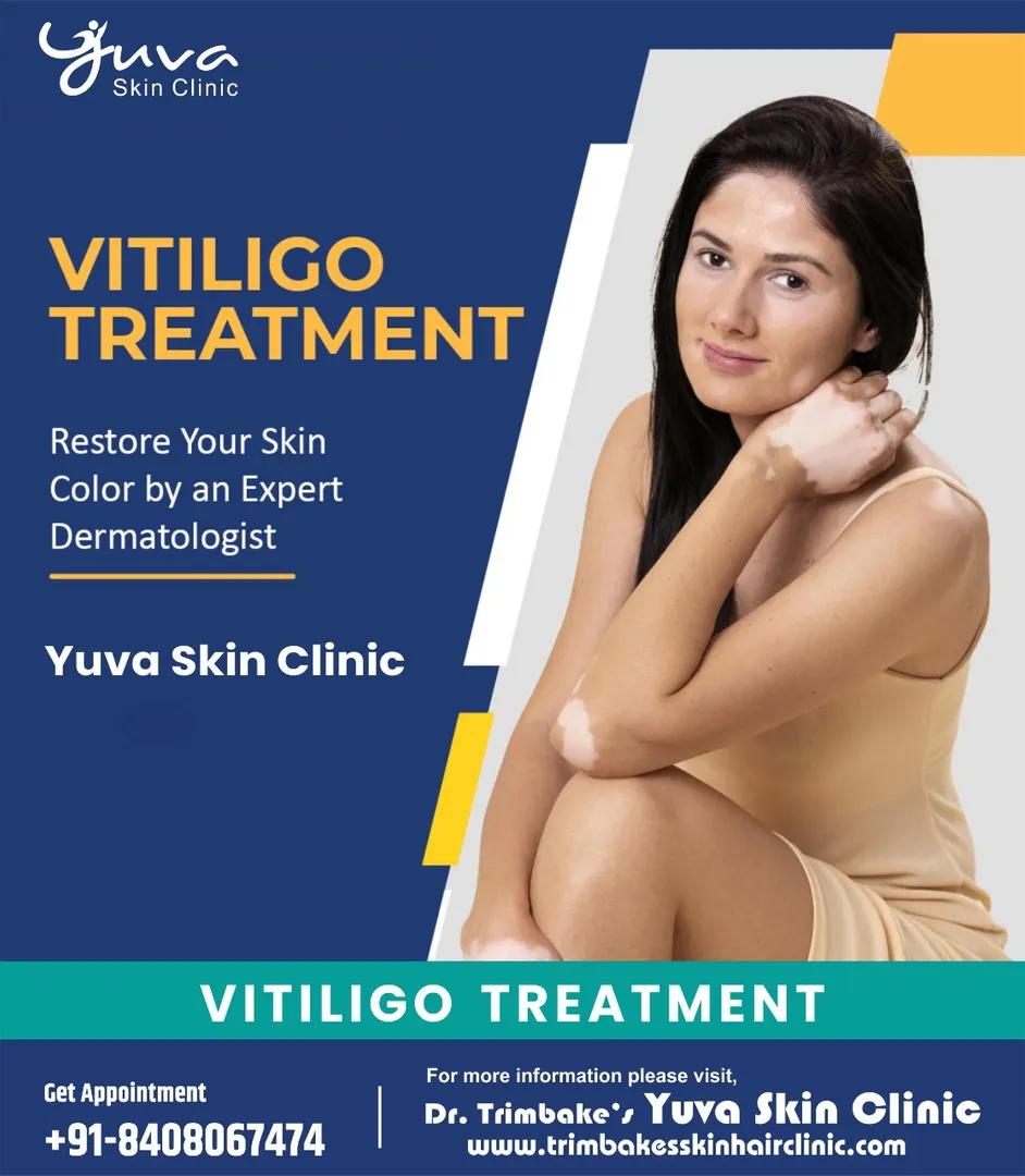 Vitiligo Treatment - Vitiligo is a genetic and aut...