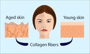 Laser Collagen Remodelling in Janakpuri -
If you...