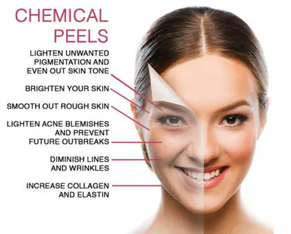 Advanced Chemical Peels in Janakpuri -
An advanc...