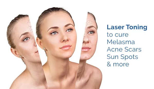 Laser Facial Toning in Janakpuri -
Laser toning ...
