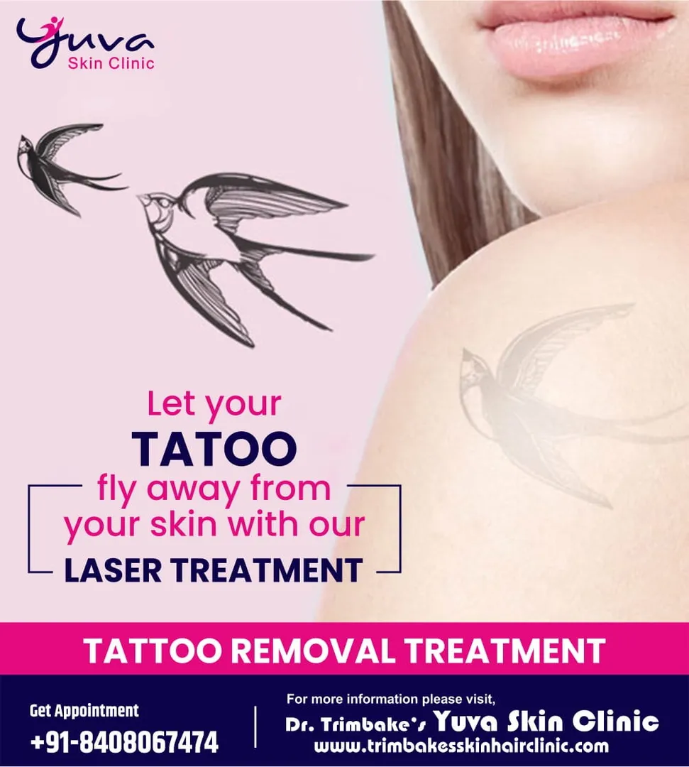 Tattoo Removal Treatment
Getting bored of your per...