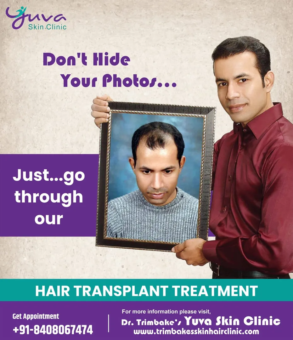 Dont hide your photos due to baldness...
Everyone ...