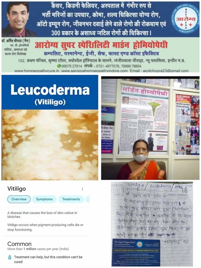 सफ़ेद दाग Vitiligo/Leucoderma cured/responded for A...