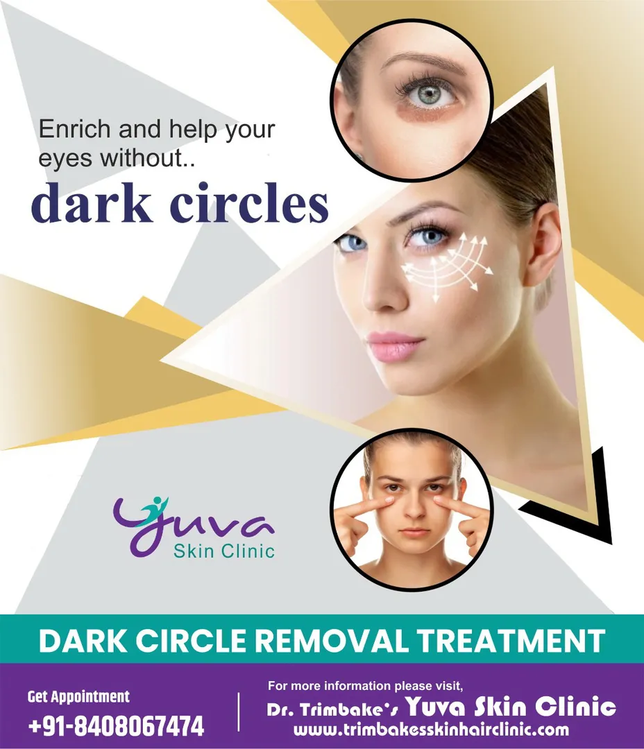 Dark circle removal treatment
Eyes are one of the...