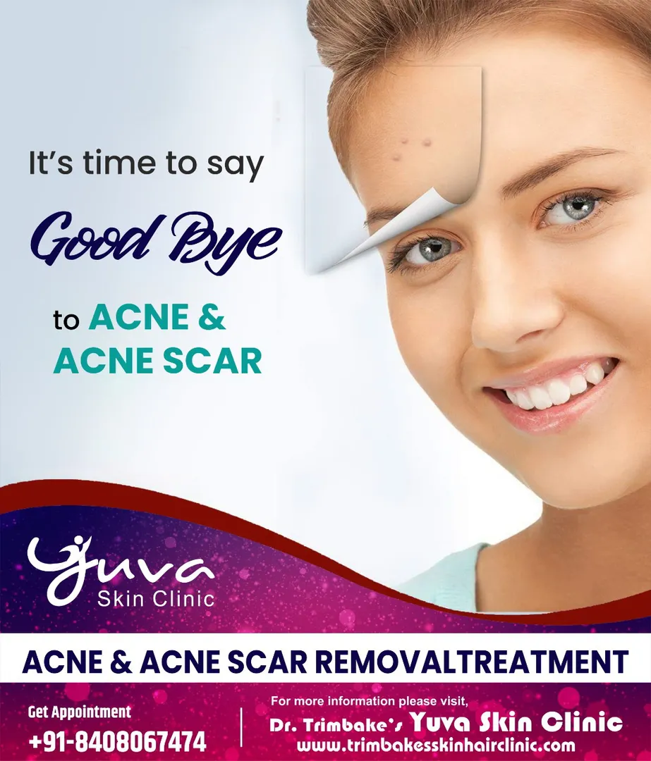 Say good bye to Acne & amp; Acne Scar
Acne can be ...