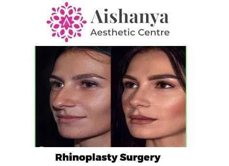 Rhinoplasty is one of the most Complicated Cosmeti...