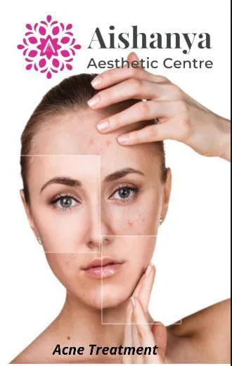 Best Acne Treatment in Janakpuri and Delhi
Acne ...