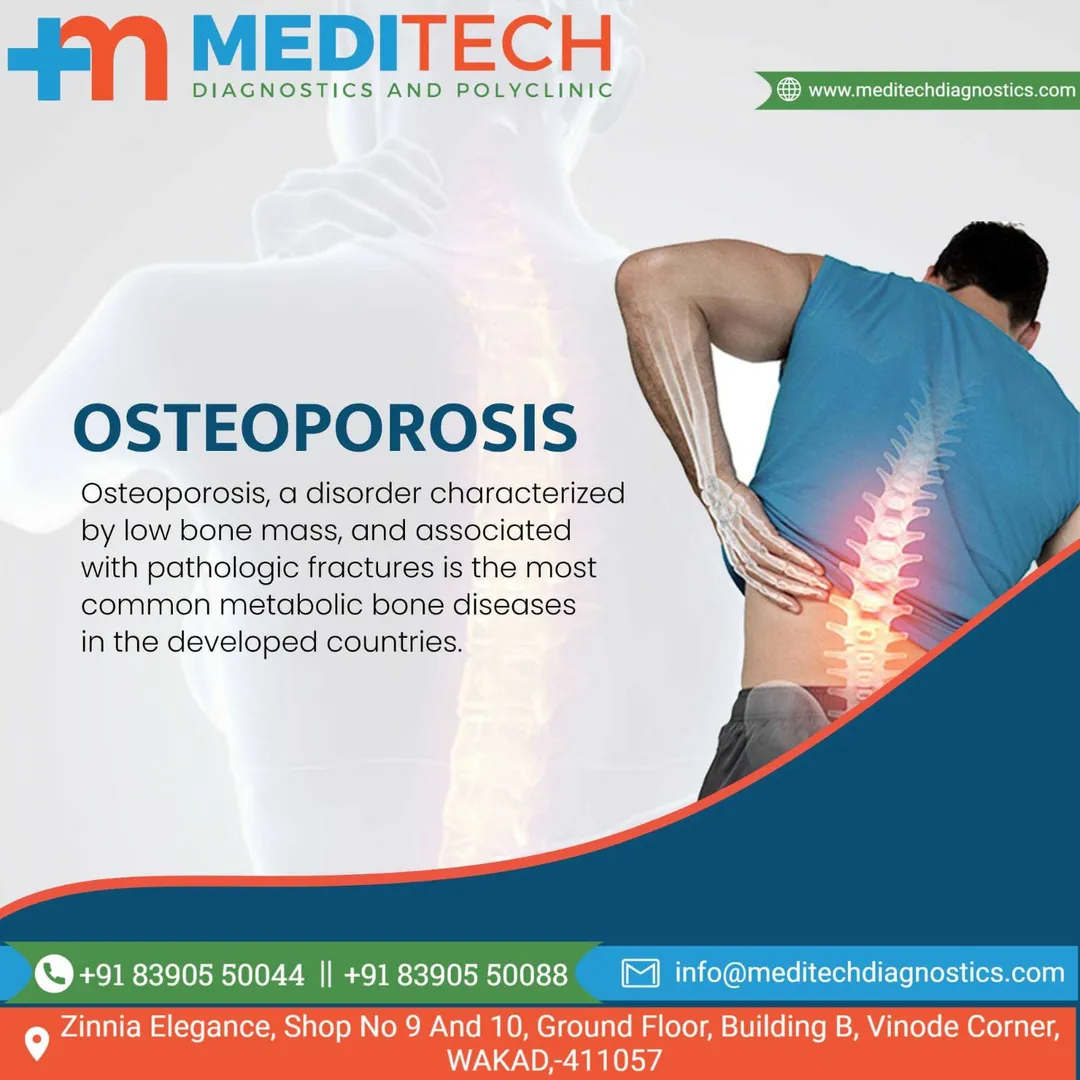 *worldosteoporosisday *
Osteoporosis is a disease ...