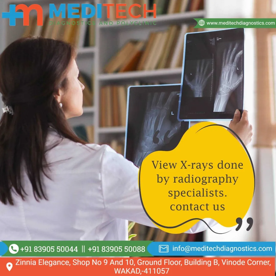 Searching for Xray, Dkull, abdomen Pain, Chest Pai...