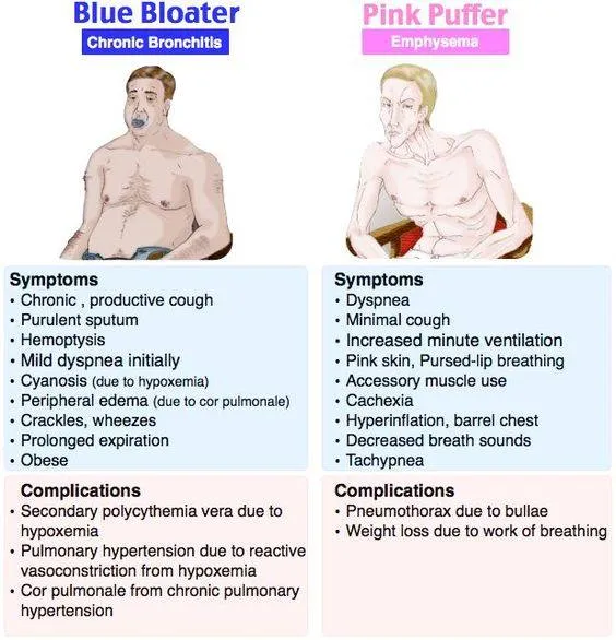 Chronic obstructive pulmonary disease (COPD) is a ...